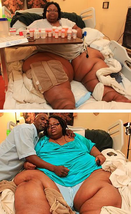 A woman believed to be the world's fattest at 50 stone (700 lbs.) is facing a battle to shed weight after being told by doctors she could die.